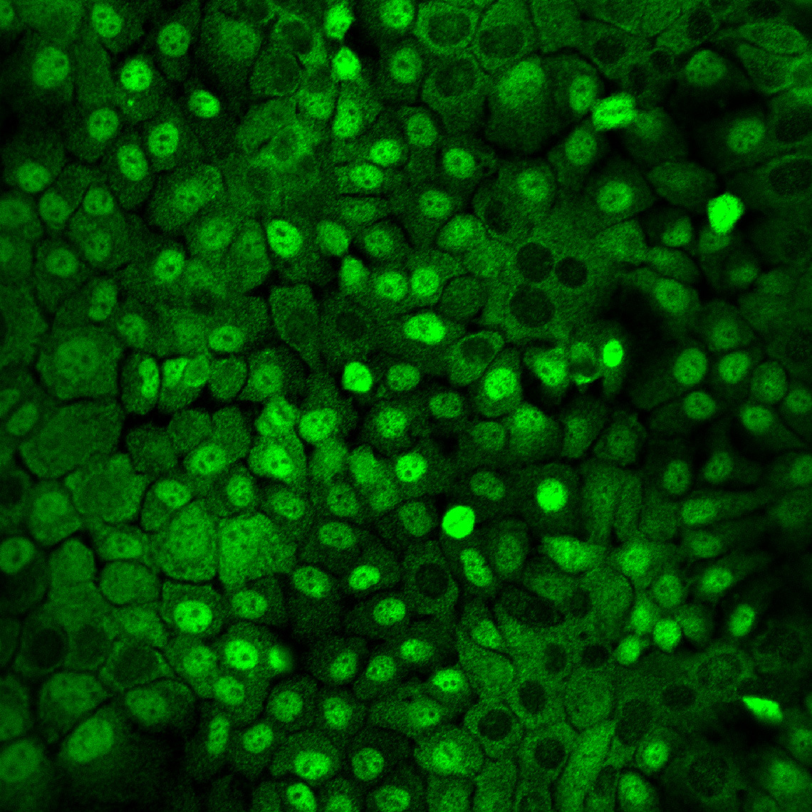 65202a8013ae0123c8c889cd-1